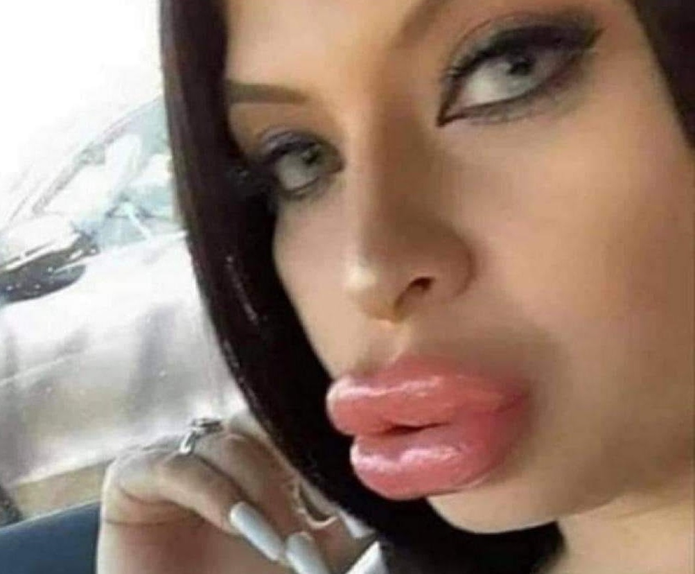 Odštopavam sudopere jednim poljupcem